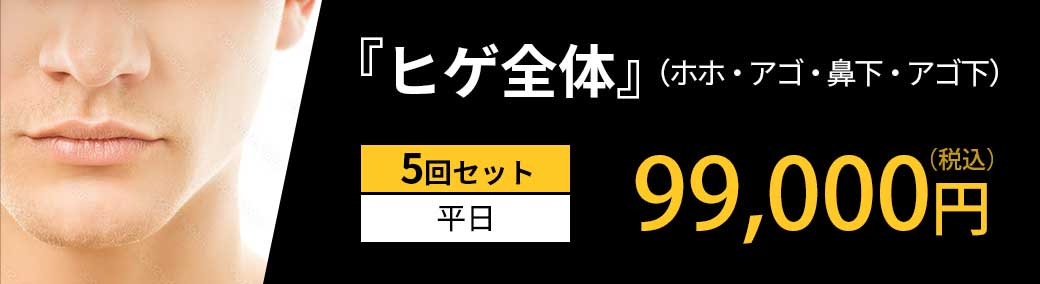 「ヒゲ全体」（ホホ・アゴ・鼻下・アゴ下）5回セット 平日 99,000円（税込）