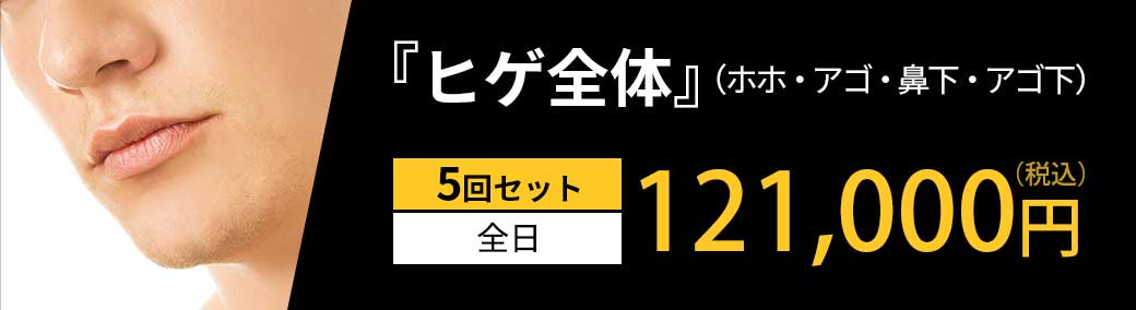 「ヒゲ全体」（ホホ・アゴ・鼻下・アゴ下）5回セット 全日 121,000円（税込）